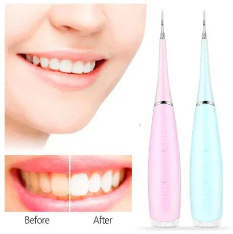 Portable Electric Sonic Dental Scaler UAE